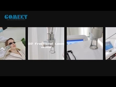 Fraksi CO2 Laser Peremajaan Kulit Peregangan Kulit