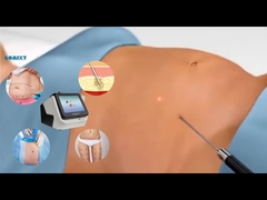 Peralatan Laser Lipo 30W 60W 980nm Diode Lipo Laser Mesin Untuk Kehilangan Berat Badan